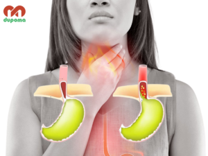 Trào ngược dạ dày thực quản – GERD