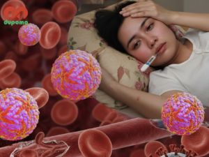 Sốt xuất huyết Dengue