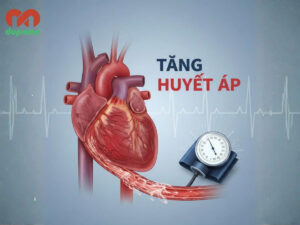 Tăng huyết áp