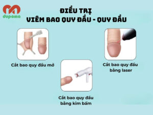 Điều trị viêm quy đầu và bao quy đầu