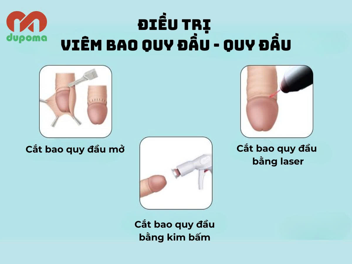 Điều trị viêm quy đầu và bao quy đầu