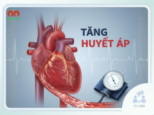 Tăng huyết áp