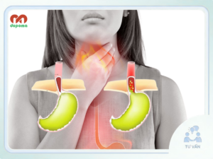 Trào ngược dạ dày thực quản – GERD