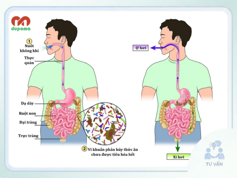 Trung tiện – Xì hơi – Đánh rắm