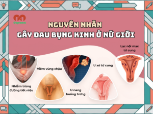 Nguyên nhân gây đau bụng kinh