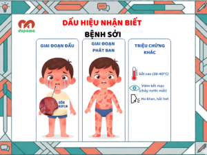 Dấu hiệu nhận biết bệnh sởi