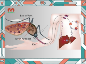 Nguyên nhân gây bệnh sốt xuất huyết Dengue
