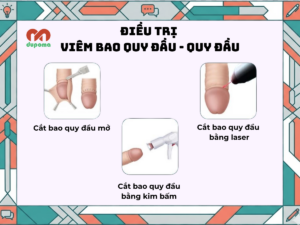Điều trị viêm quy đầu và bao quy đầu
