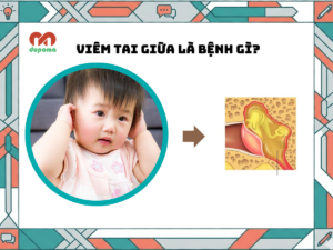 Viêm tai giữa là bệnh gì?