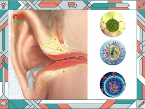 Nguyên nhân gây viêm tai giữa cấp tính