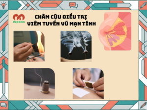 Châm cứu điều trị viêm tuyến vú mạn tính