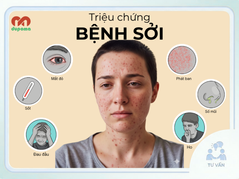 Sởi
